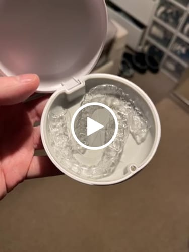 Customer video review of Essix Retainers