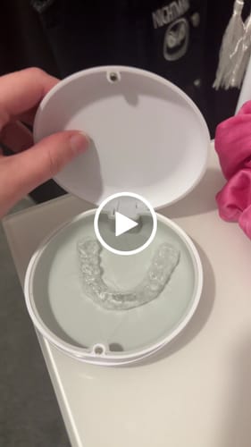 Customer video review of Essix Retainers