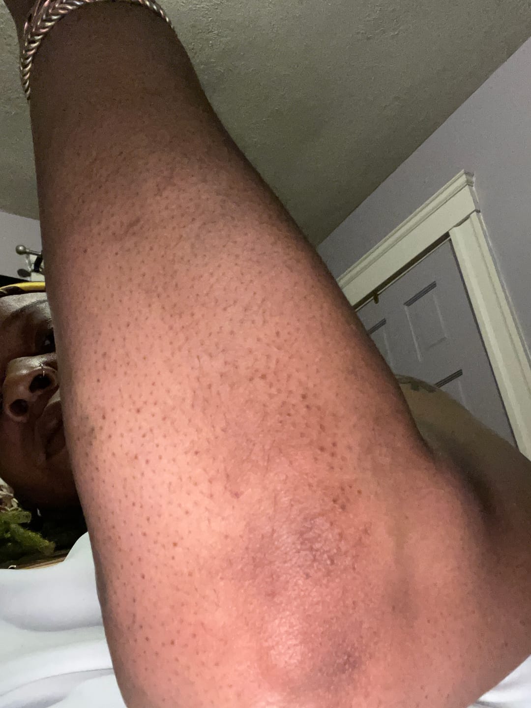 Customer photo review of Magic Eraser Dark Spot Cream