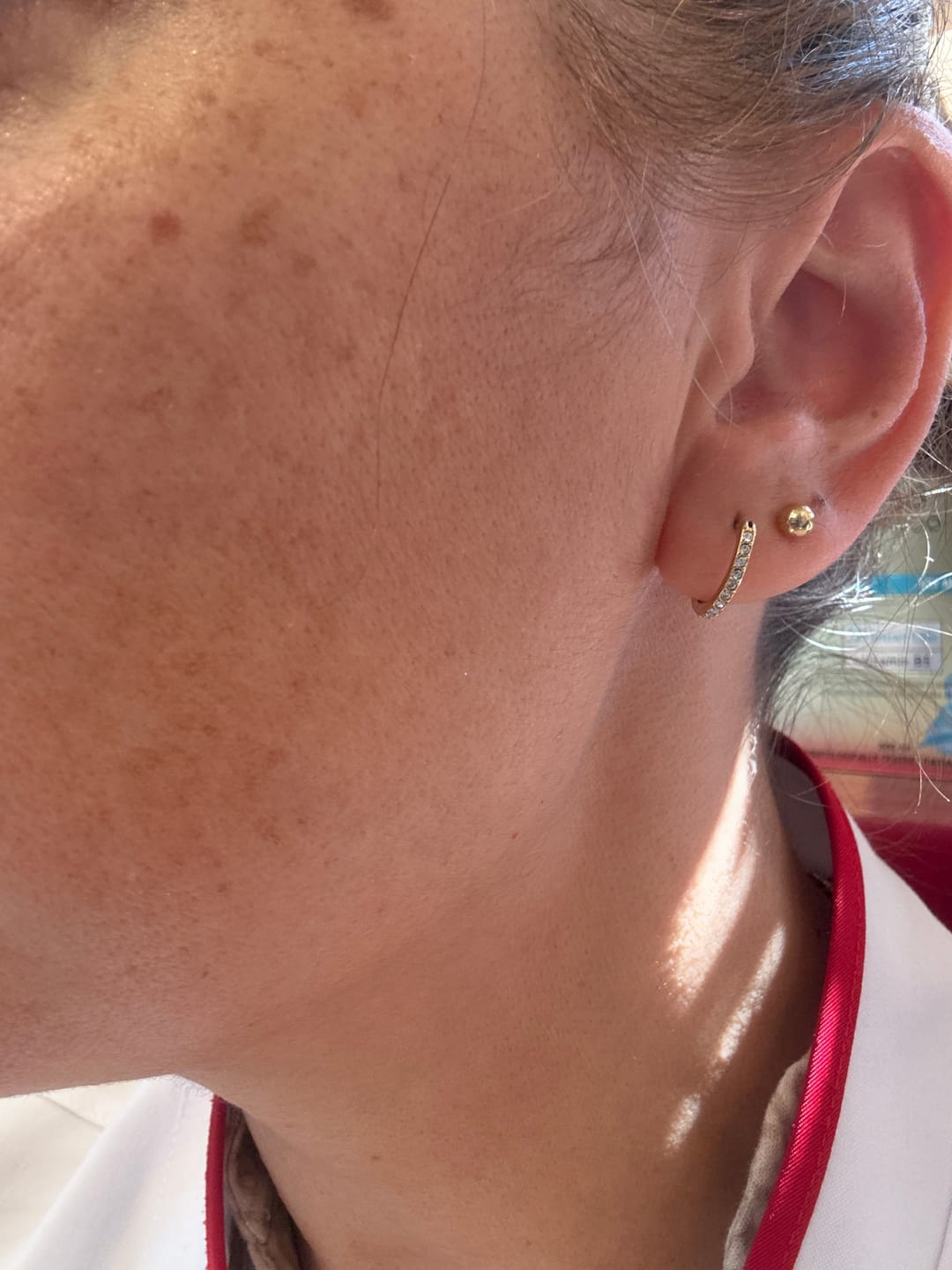 Customer photo review of Remedium Gece Merhemi