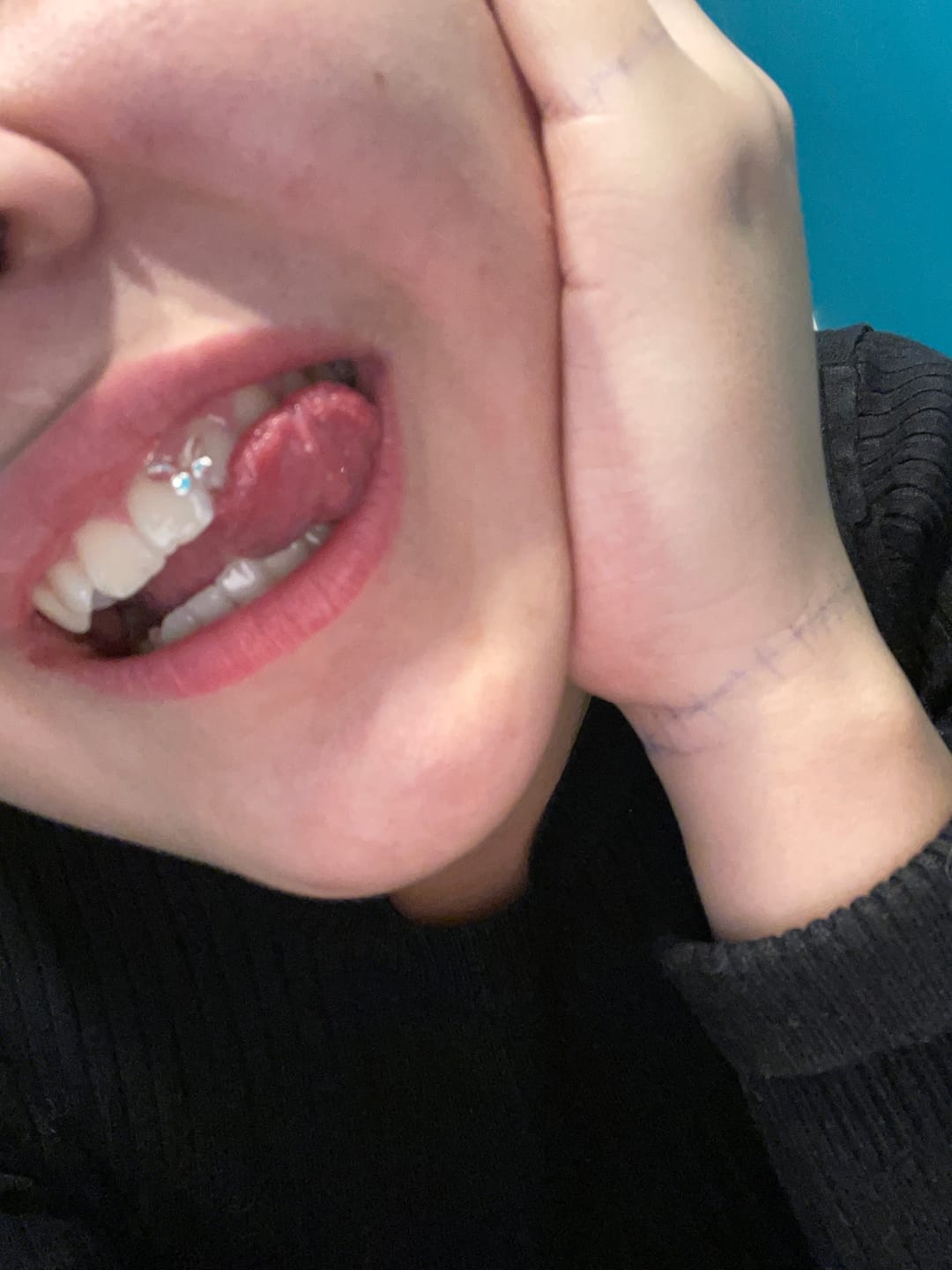Customer photo review of Crystal Clear Butterfly 4-pack