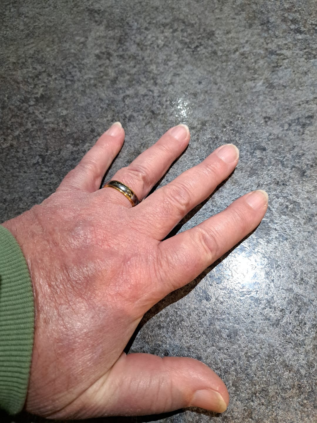 Customer photo review of Vulcan Mirror 6mm Wonder Ring