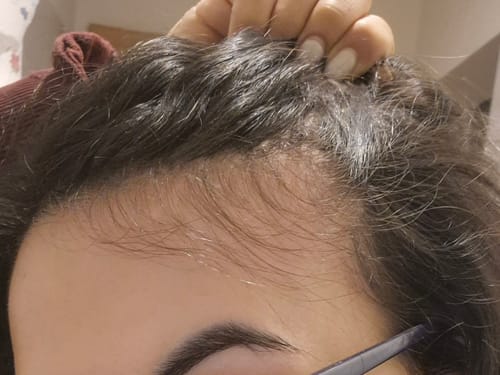 Customer photo review of Витализиращ серум срещу косопад с крио ефект Doori Тайни от Изтока