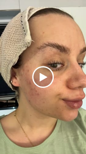 Customer video review of GLOW DUOs