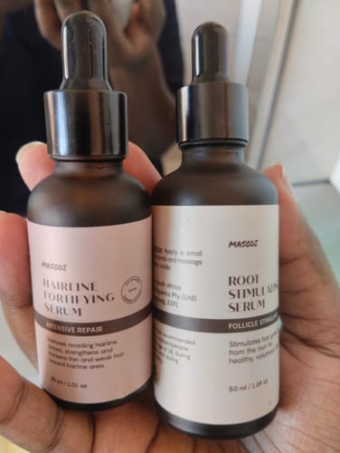 Customer photo review of Scalp Serum Set - Minoxidil