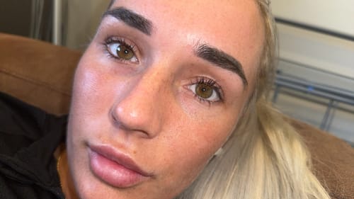 Customer photo review of Lash Growth Serum