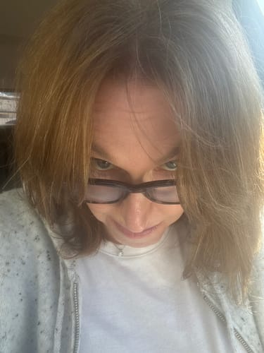 Customer photo review of VITAFOAM ™ Hair Growth Formula