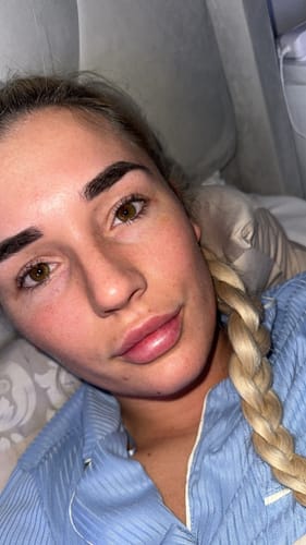 Customer photo review of Lash Growth Serum