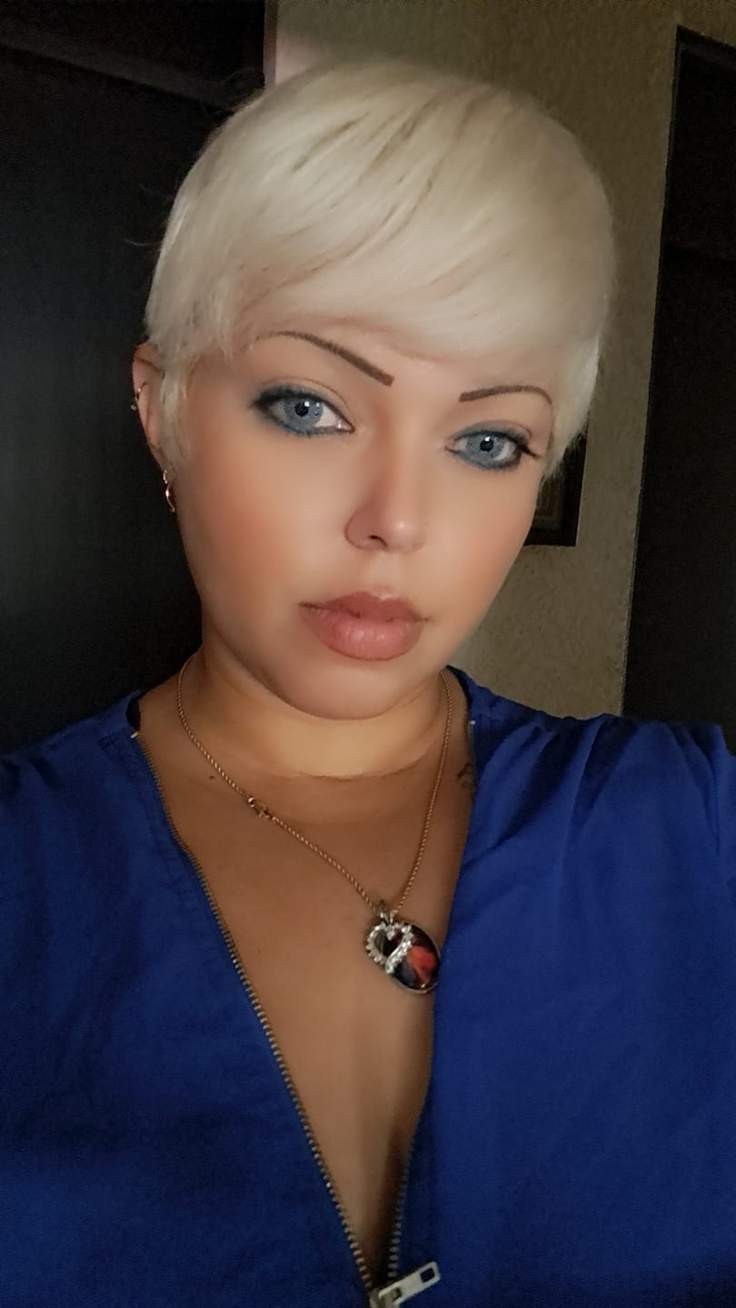 Customer photo review of Clover Blue Prescription Colored Contact Lenses