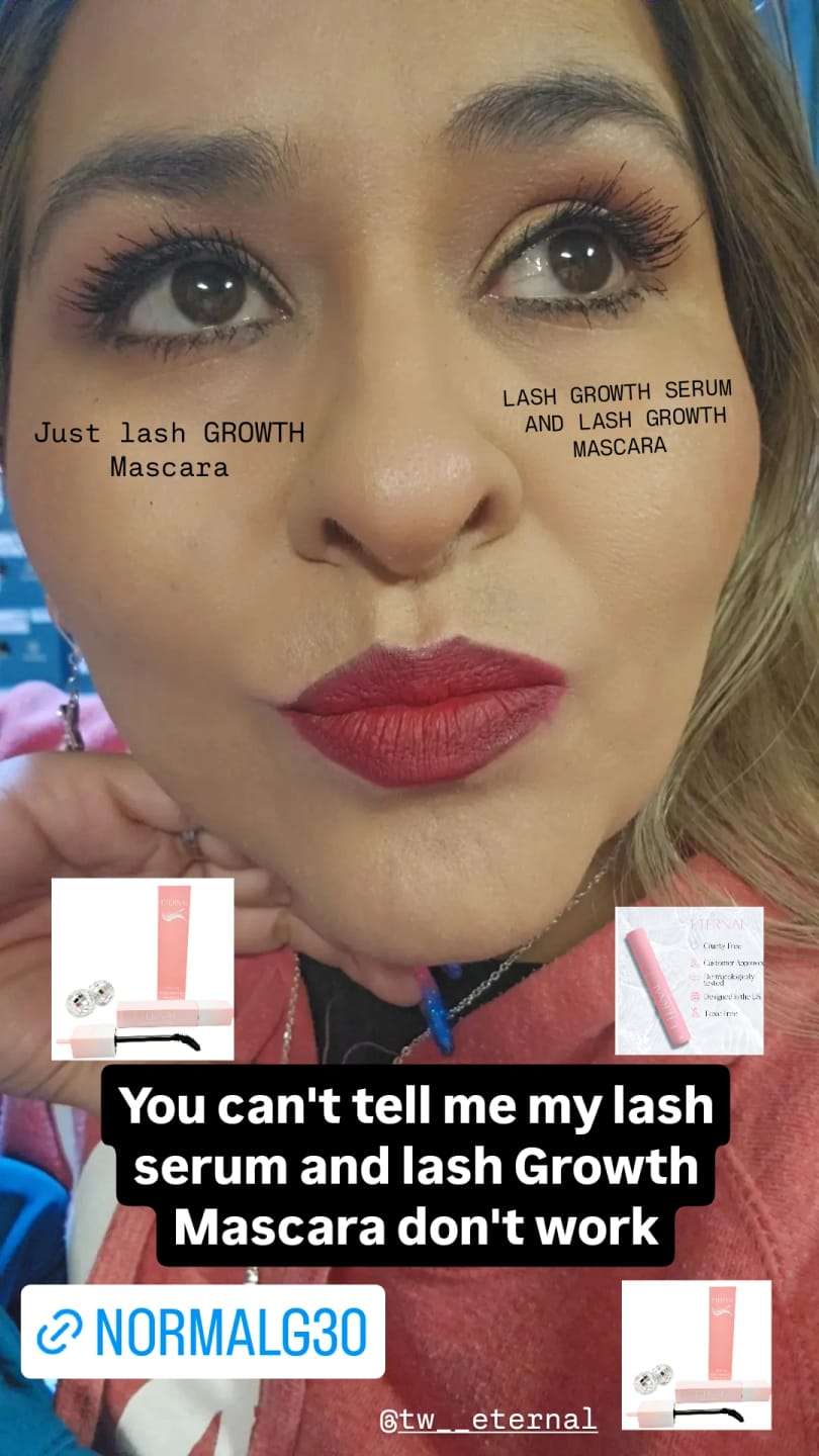 Customer photo review of EYELASH GROWTH SOLUTION