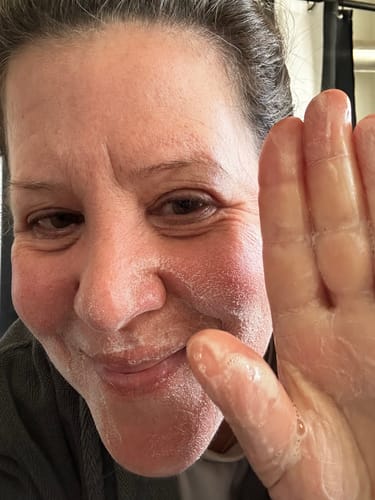 Customer photo review of Exfoliating Bar - Tepezcohuite