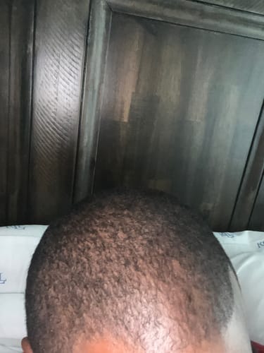 Customer photo review of Rennora Hair Growth Serum