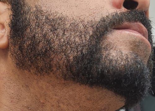 Customer photo review of Beard Care Kit
