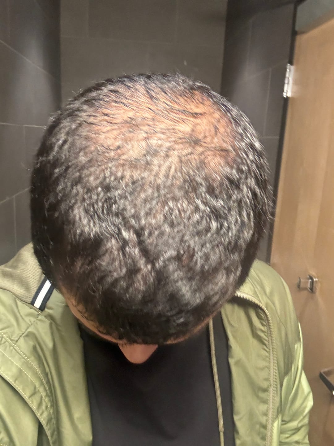 Customer photo review of Complex10™ Hair Growth Supplement