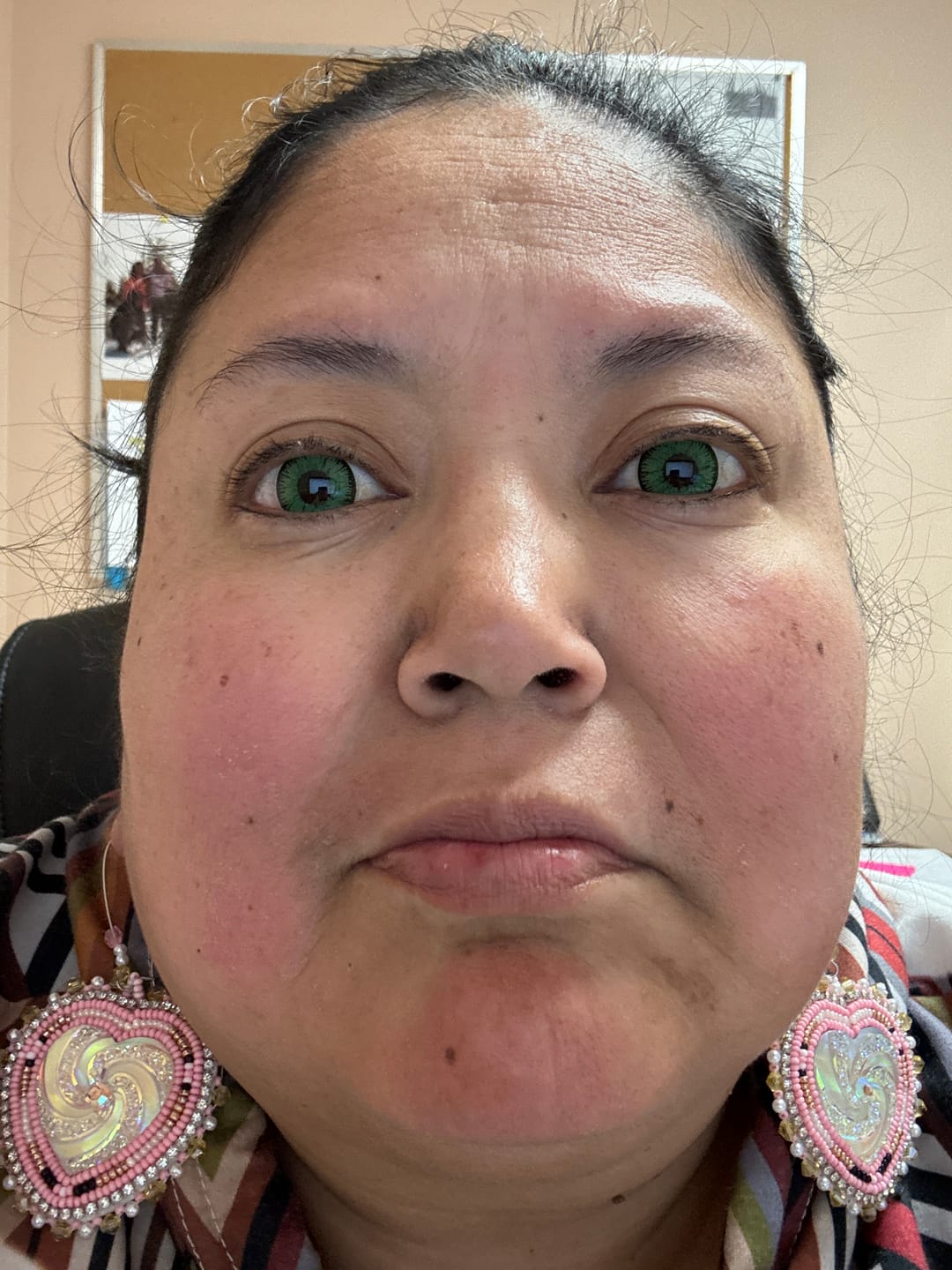 Customer photo review of Vega Bright Forest Green Prescription Colored Contact Lenses