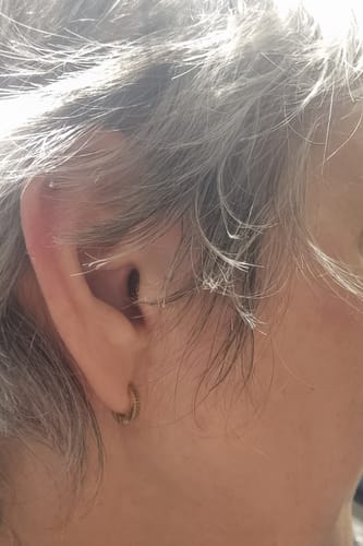 Customer photo review of Mini Pleat Huggies