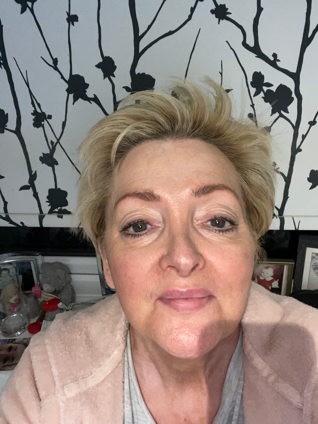 Customer photo review of Anti-Aging treatment