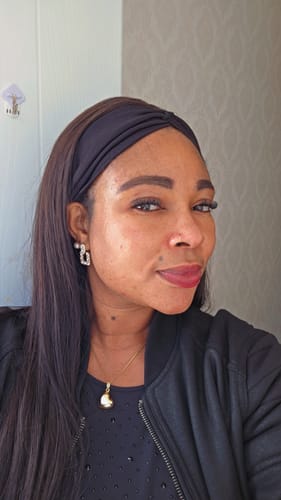 Customer photo review of Anti-Acne & Dark Spots African Soap