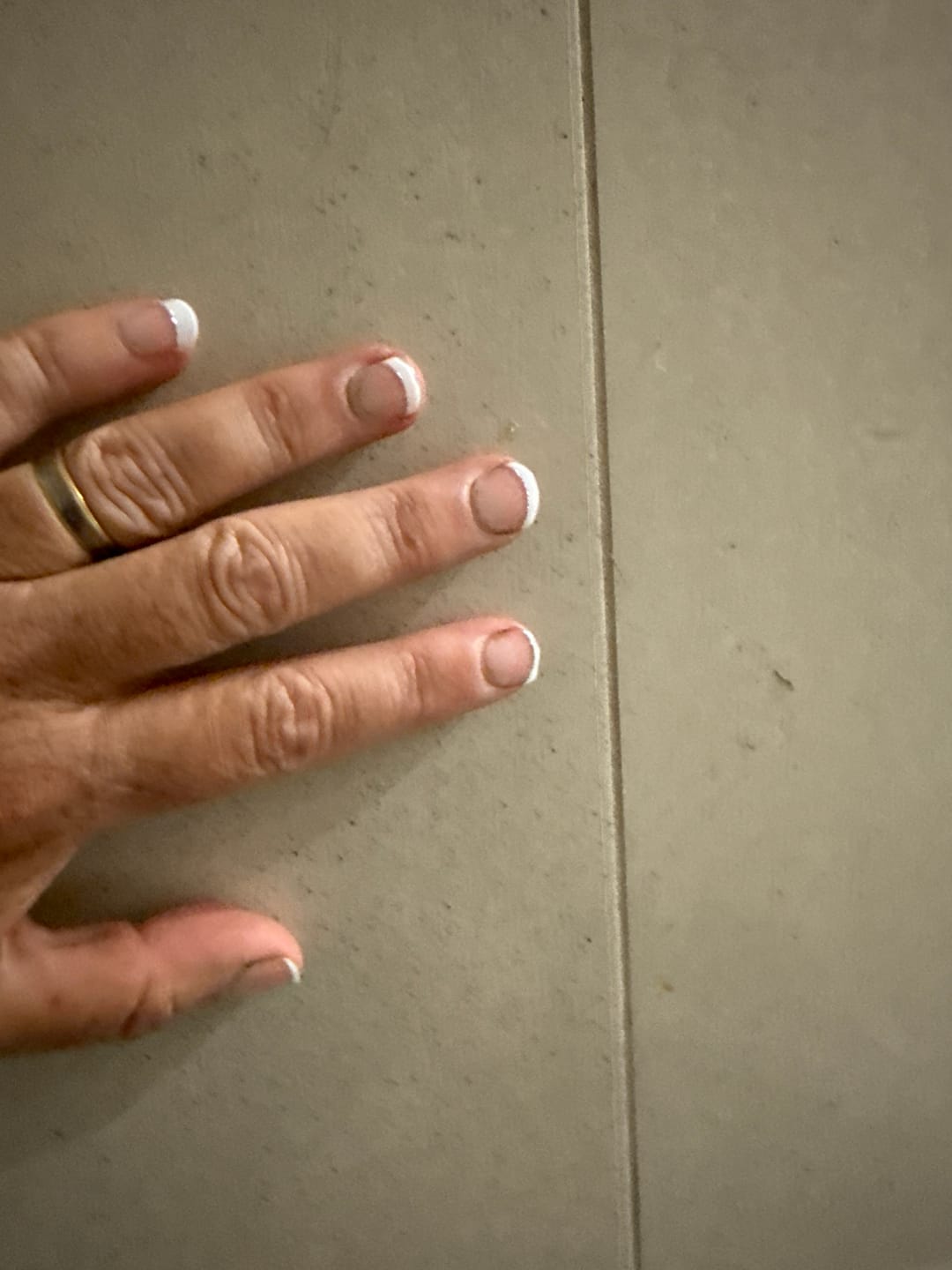 Customer photo review of Crystal Clear DIY Semicured Gel Nail Sticker Kit (STOP NAIL BITING & GROW BRITTLE NAILS)