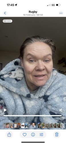 Customer photo review of 5-Step Clear Skin Kit