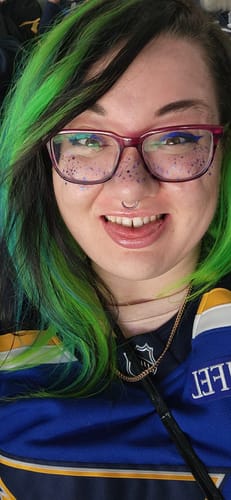 Customer photo review of Gold + Blue Speckles Makeup Patches
