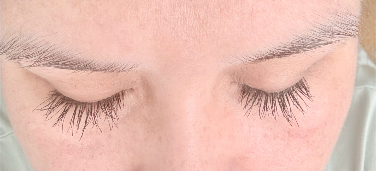 Customer photo review of fLASH EYELASH SERUM
