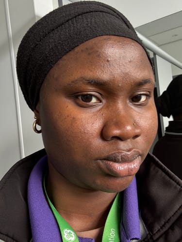 Customer photo review of Turmeric Glow Soap