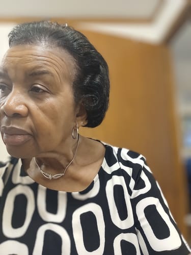 Customer photo review of Rennora Hair Growth Serum