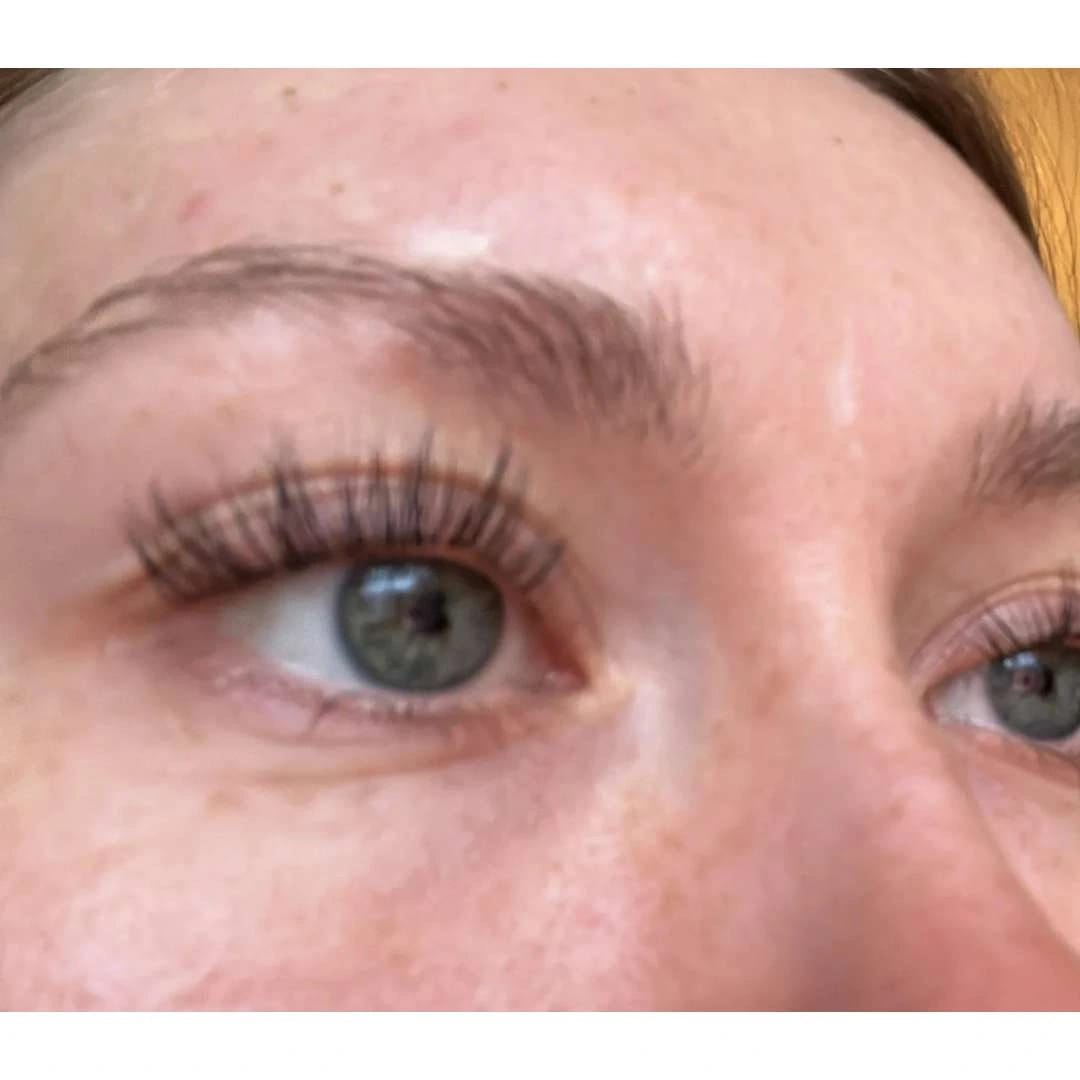 Customer photo review of LV CHAMPS EYELASH SERUM