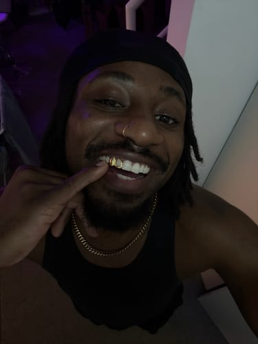 Customer photo review of PRISM (GOLD PLATED GRILLZ)