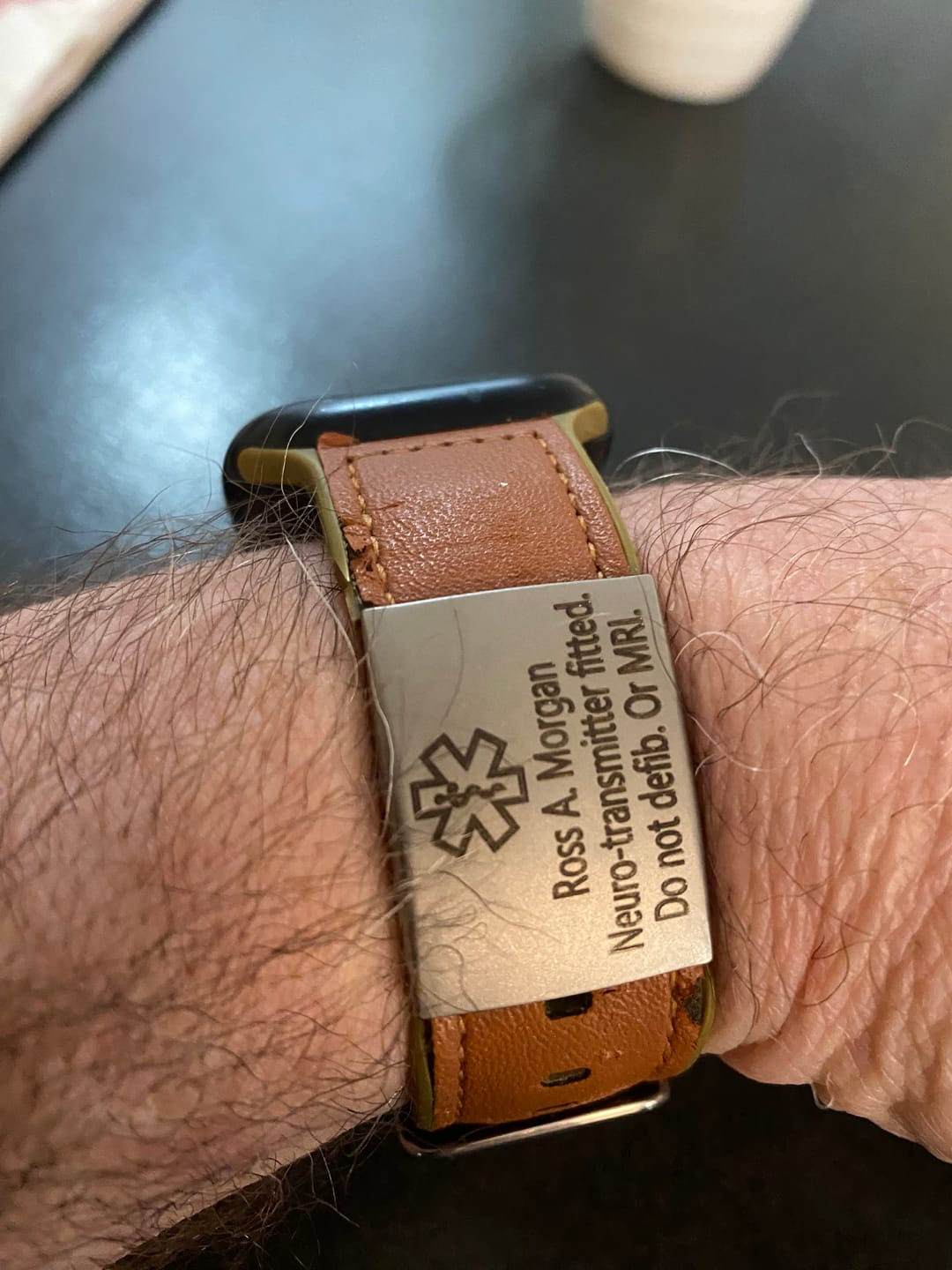 Customer photo review of Personalised ID Tag for Watch Band & Fitness Trackers