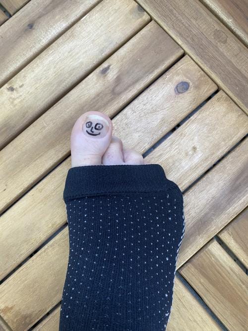 Customer photo review of Kompressionsstrumpor för blodcirkulation