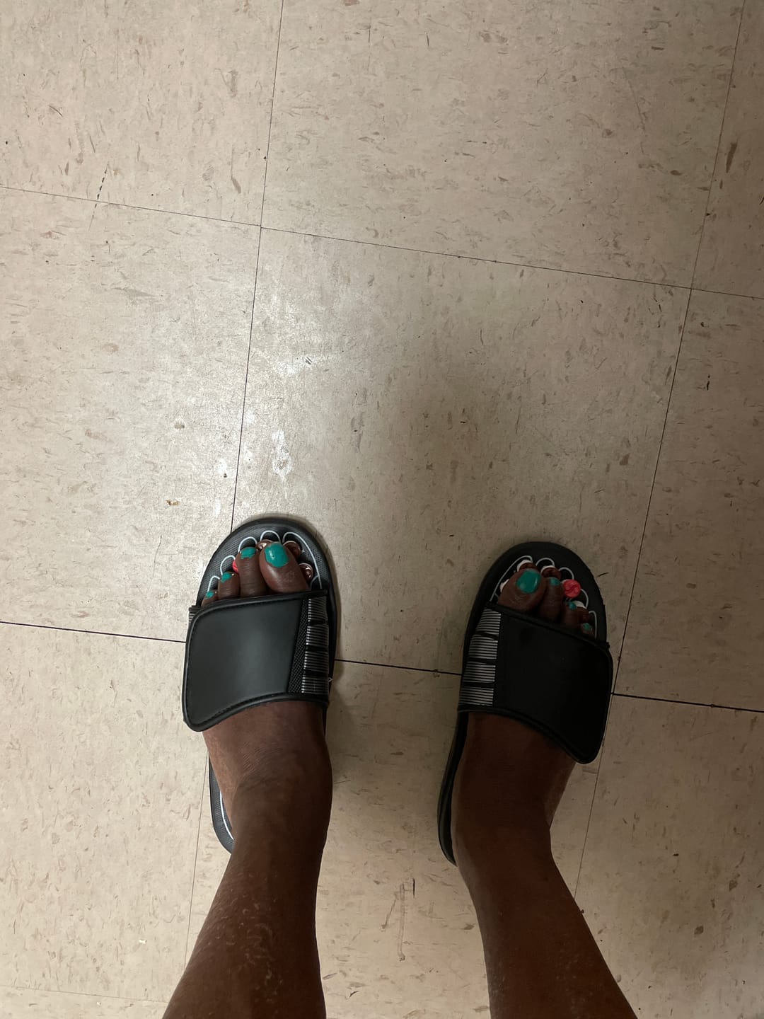 Customer photo review of Acupressure Sandals