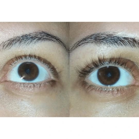 Customer photo review of LV CHAMPS EYELASH SERUM