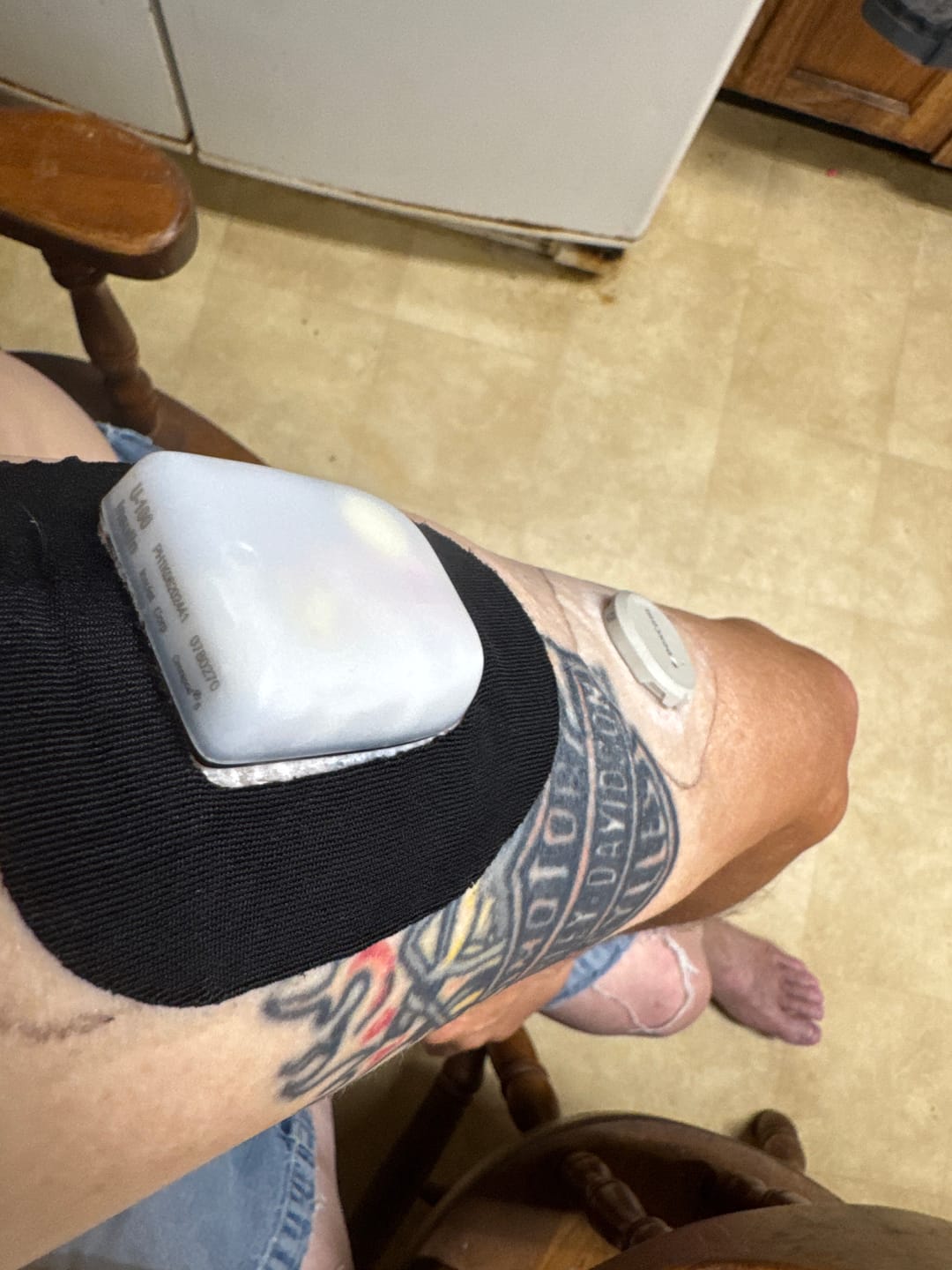 Customer photo review of Skin Grip Original - Omnipod Adhesive Patches