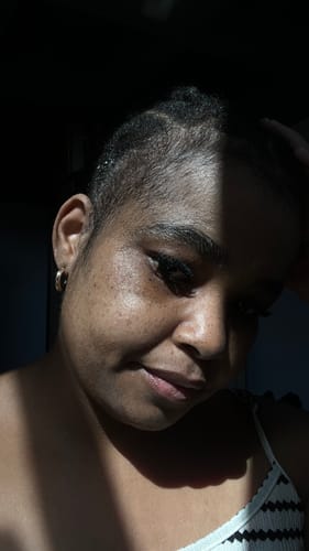 Customer photo review of Minoxi5 Minoxidil SOLUTION, 3 PACK