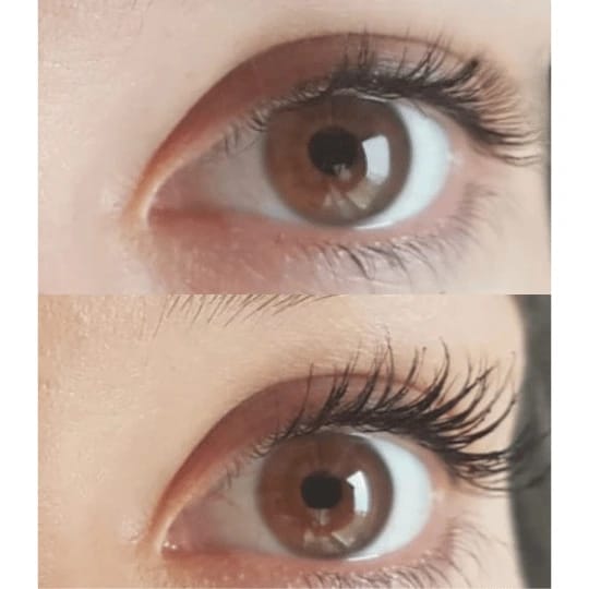 Customer photo review of LV CHAMPS EYELASH SERUM