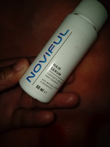 Customer photo review of NOVIFUL Hair Growth Serum - 3 PACK (3 Month supply)