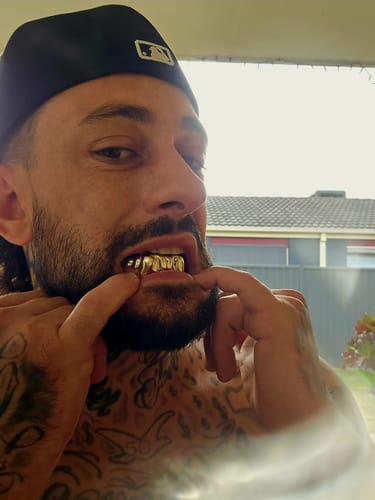 Customer photo review of NEXIS (GOLD GRILLZ)