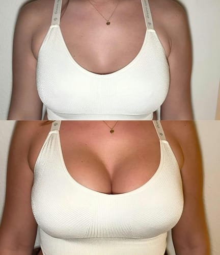 Customer photo review of Snowy Care Push-Up Etkili Yapışkan Göğüs Pedleri