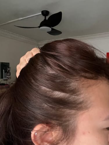 Customer photo review of Pre-Wash Scalp Oil by TR