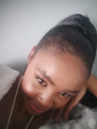 Customer photo review of Minoxi5 FOAM, 1 PACK