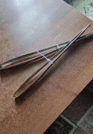 Customer photo review of Stainless Steel Kitchen Tongs