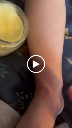 Customer video review of Calm Balm