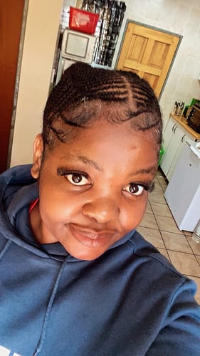 Customer photo review of Minoxi5 Minoxidil SOLUTION, 6 PACK