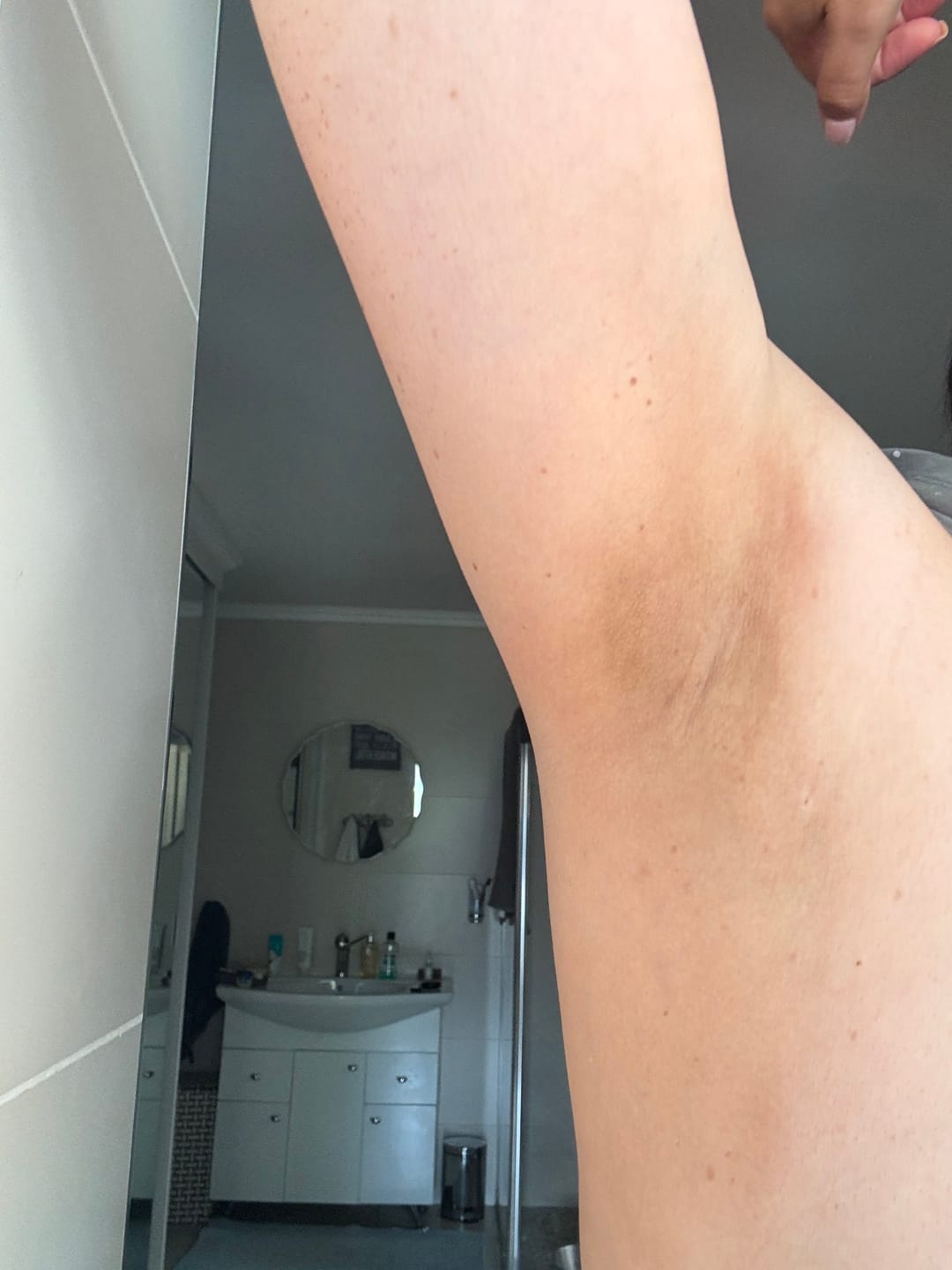 Customer photo review of Bright Skin Bish