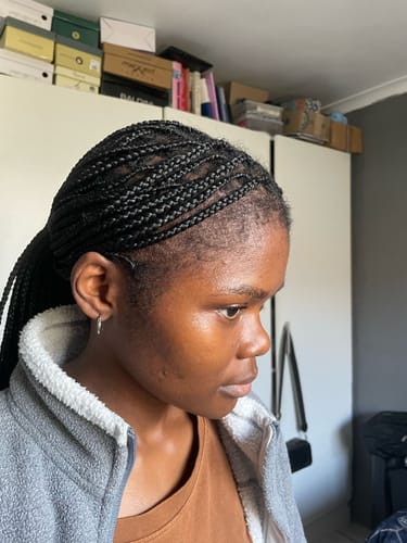 Customer photo review of Minoxi5 Minoxidil SOLUTION, 1 PACK