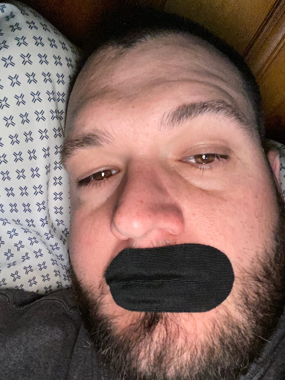 Customer photo review of 2 More Months Mouth Tape Special Offer