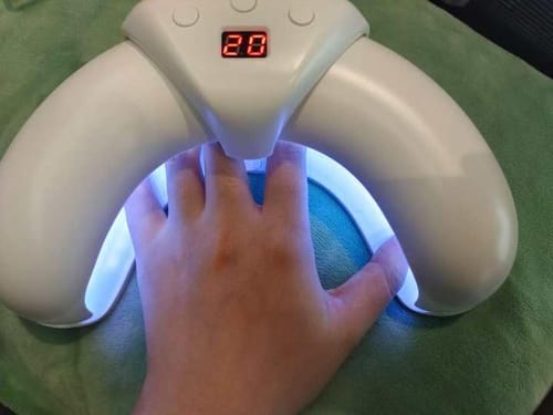 Customer photo review of LumaNail - Nail Fungus Laser Removal