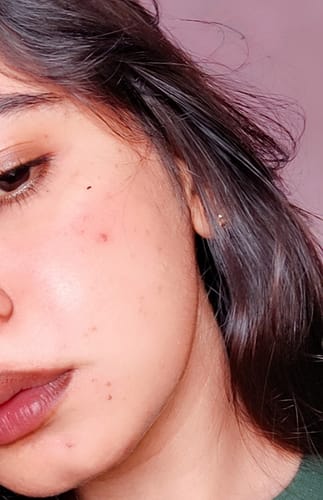 Customer photo review of DREAM CREAM - Instant Skin Reviver